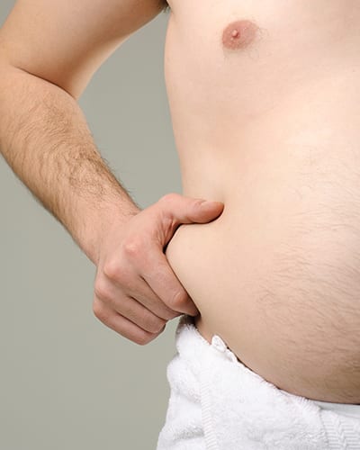 Liposuction