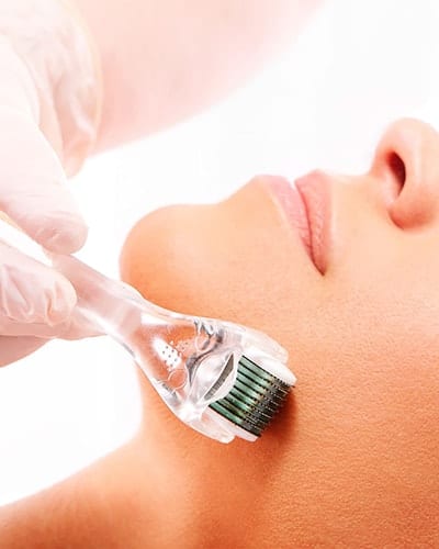 Peelings y microneedling